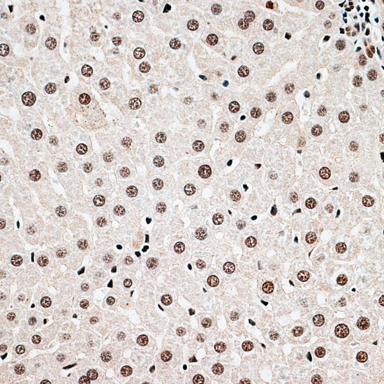 CBX6 Rabbit Polyclonal Antibody - Image 2