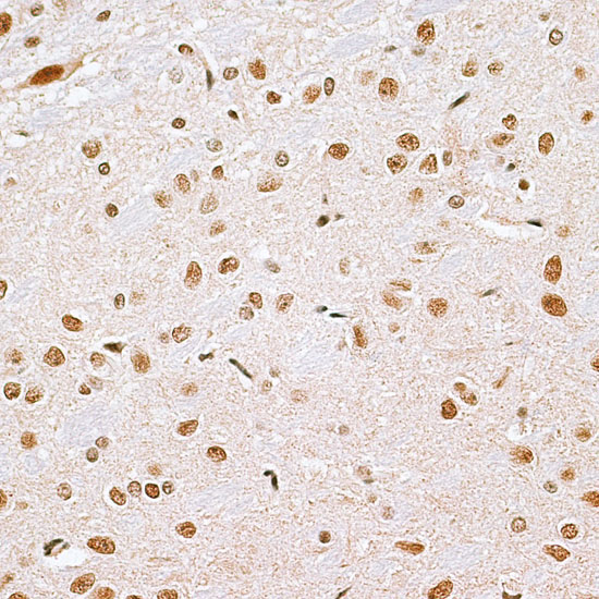 CBX6 Rabbit Polyclonal Antibody - Image 3