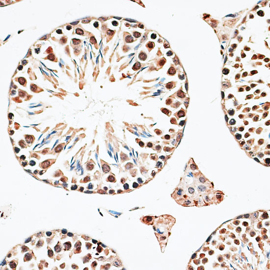 CBX6 Rabbit Polyclonal Antibody - Image 4