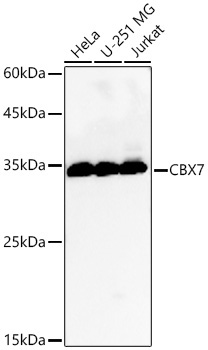 CBX7 Rabbit Polyclonal Antibody