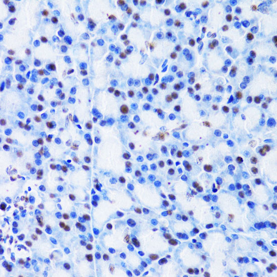 CBX8 Rabbit Polyclonal Antibody - Image 2