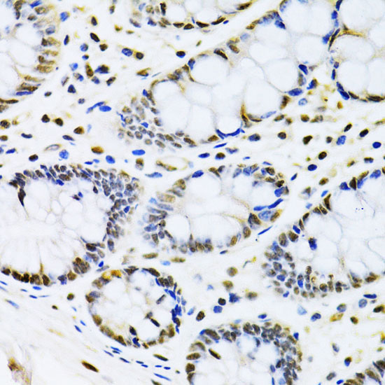 CBX8 Rabbit Polyclonal Antibody - Image 3