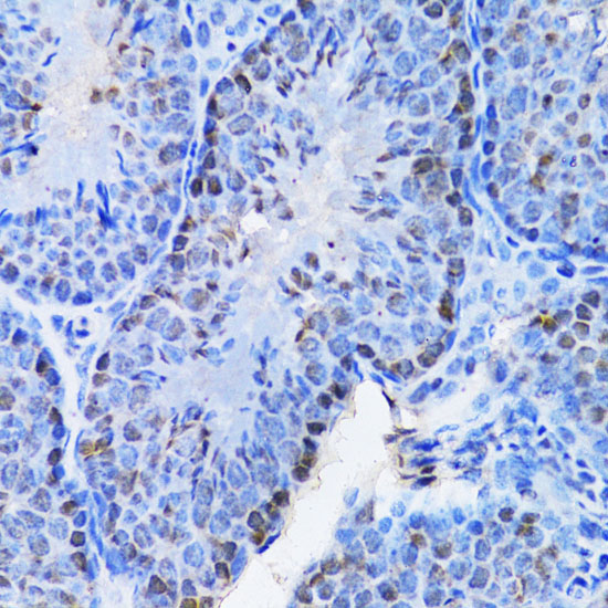 CBX8 Rabbit Polyclonal Antibody - Image 4
