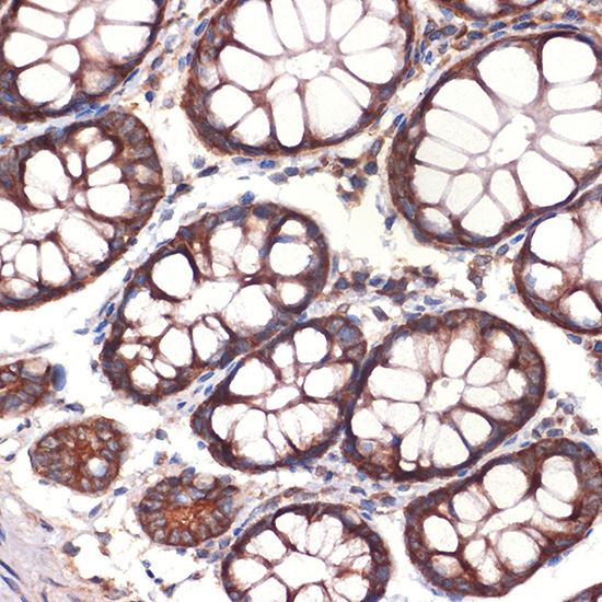 CC2D1A Rabbit Monoclonal Antibody