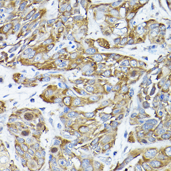 CC2D1A Rabbit Polyclonal Antibody - Image 2