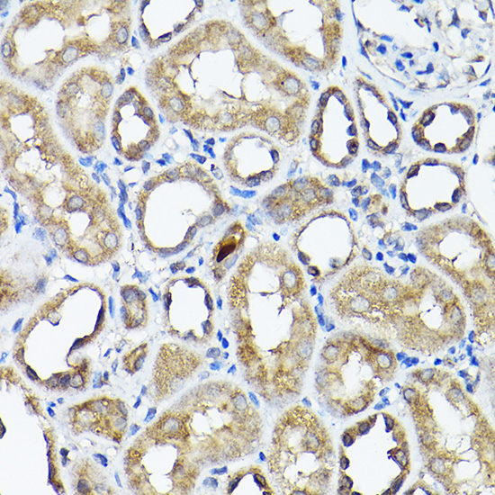 CC2D1A Rabbit Polyclonal Antibody - Image 3