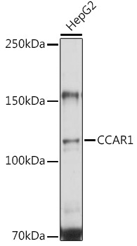 CCAR1 Rabbit Polyclonal Antibody - Image 2