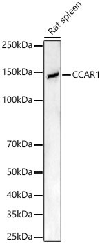 CCAR1 Rabbit Polyclonal Antibody - Image 3