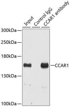CCAR1 Rabbit Polyclonal Antibody - Image 4