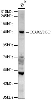 CCAR2/DBC1 Rabbit Polyclonal Antibody