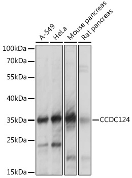 CCDC124 Rabbit Polyclonal Antibody