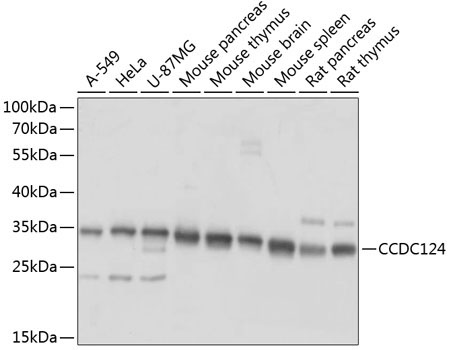CCDC124 Rabbit Polyclonal Antibody