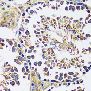 CCDC124 Rabbit Polyclonal Antibody - Image 2