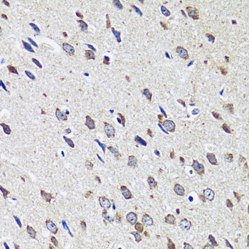 CCDC124 Rabbit Polyclonal Antibody - Image 3