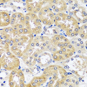 CCDC124 Rabbit Polyclonal Antibody - Image 4