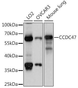 CCDC47 Rabbit Polyclonal Antibody