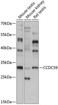 CCDC59 Rabbit Polyclonal Antibody