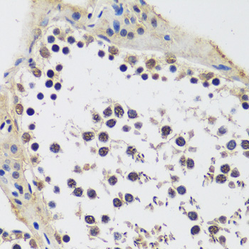 CCDC59 Rabbit Polyclonal Antibody - Image 2