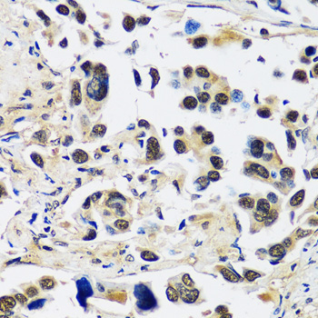 CCDC59 Rabbit Polyclonal Antibody - Image 3