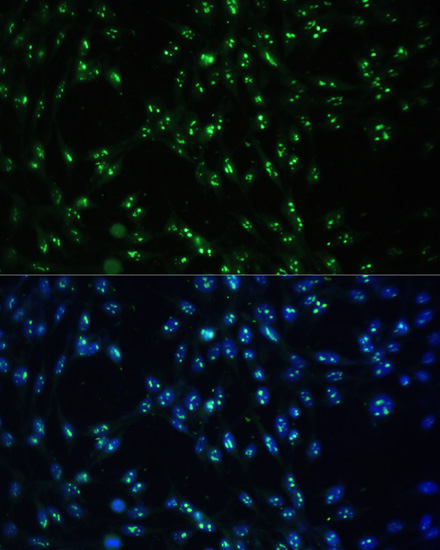 CCDC59 Rabbit Polyclonal Antibody - Image 4