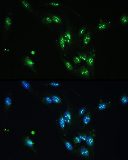 CCDC59 Rabbit Polyclonal Antibody - Image 5