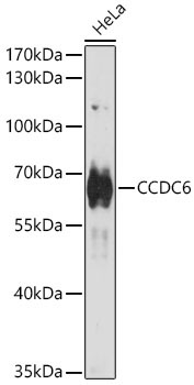 CCDC6 Rabbit Polyclonal Antibody