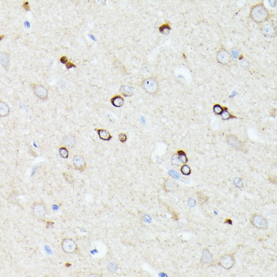 CCDC6 Rabbit Polyclonal Antibody - Image 2