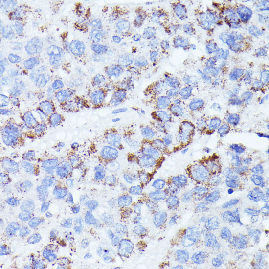 CCDC6 Rabbit Polyclonal Antibody - Image 3