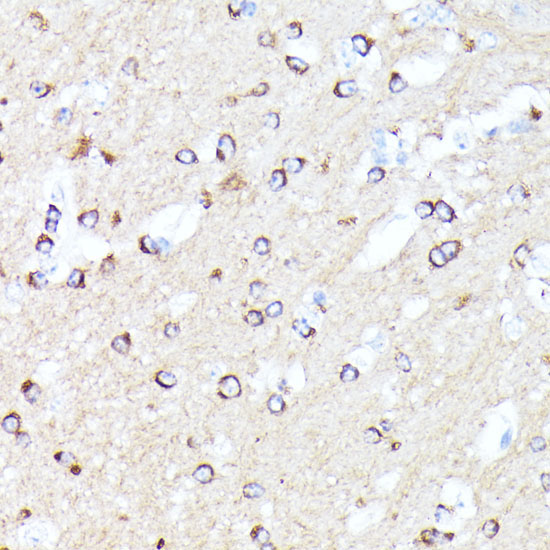 CCDC6 Rabbit Polyclonal Antibody - Image 4