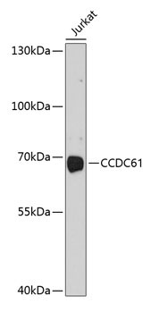 CCDC61 Rabbit Polyclonal Antibody