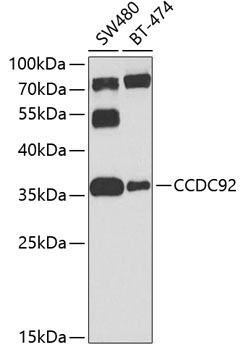CCDC92 Rabbit Polyclonal Antibody