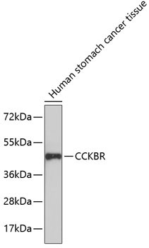 CCKBR Rabbit Polyclonal Antibody