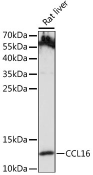 CCL16 Rabbit Polyclonal Antibody