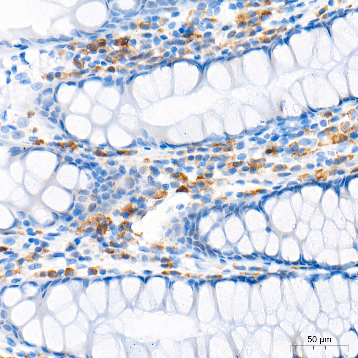 CCL17 Rabbit Monoclonal Antibody - Image 3
