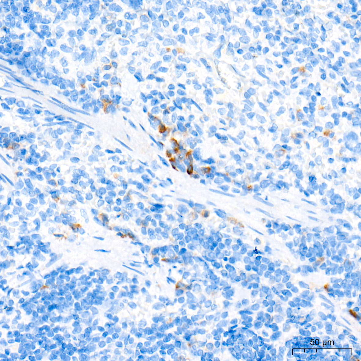 CCL17 Rabbit Monoclonal Antibody - Image 5