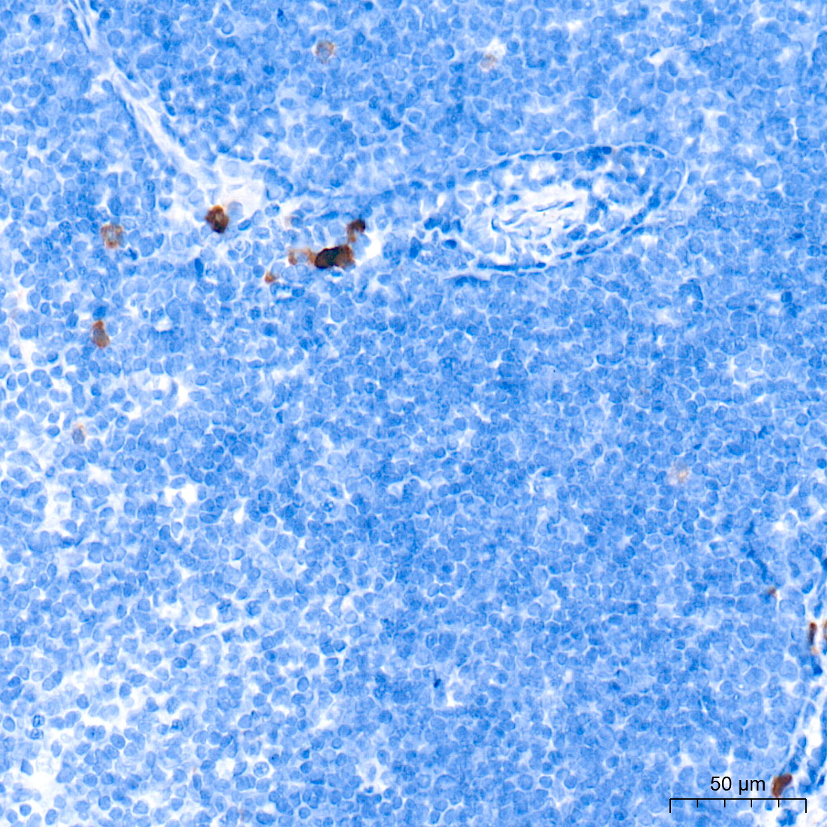 CCL17 Rabbit Monoclonal Antibody - Image 6