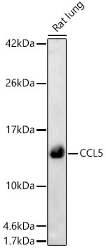 CCL5 Rabbit Polyclonal Antibody