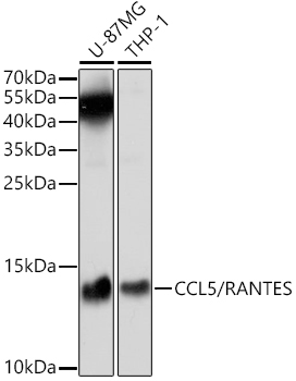 CCL5/RANTES Rabbit Polyclonal Antibody