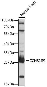 CCNB1IP1 Rabbit Polyclonal Antibody