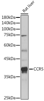 CCR5 Rabbit Polyclonal Antibody