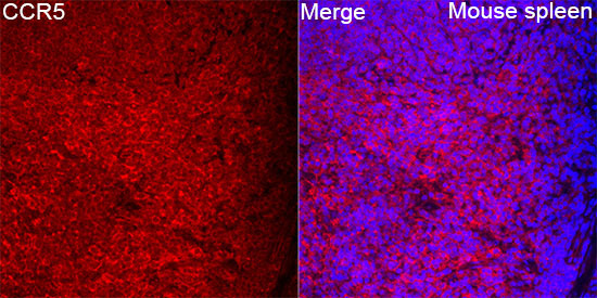 CCR5 Rabbit Polyclonal Antibody