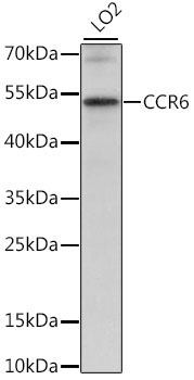 CCR6 Rabbit Polyclonal Antibody
