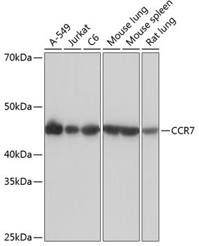 CCR7 Rabbit Monoclonal Antibody