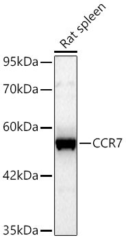 CCR7 Rabbit Polyclonal Antibody