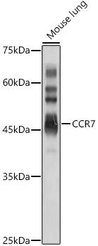 CCR7 Rabbit Polyclonal Antibody