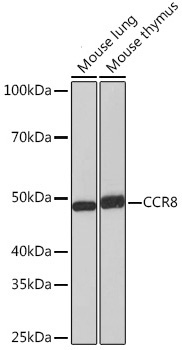 CCR8 Rabbit Monoclonal Antibody