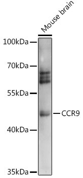 CCR9 Rabbit Polyclonal Antibody