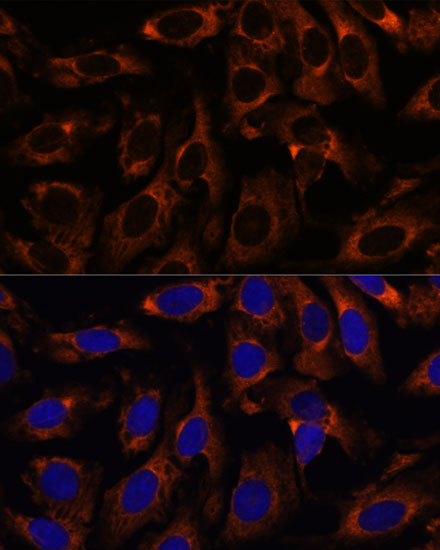 CCT3 Rabbit Polyclonal Antibody - Image 2