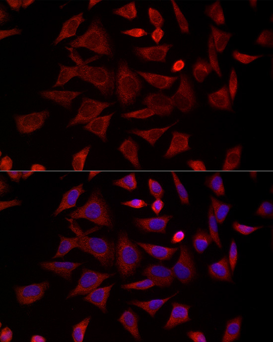 CCT4 Rabbit Polyclonal Antibody - Image 2