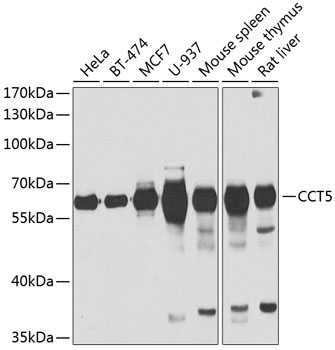 CCT5 Rabbit Polyclonal Antibody